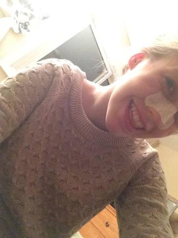 got my nose realigned