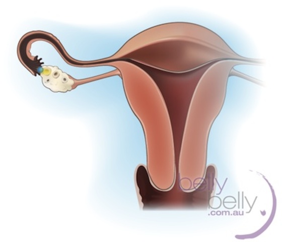 Progesterone levels build