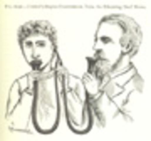 Early take on the hearing aid