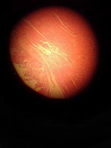 CLASIFICACION DE LA HISTOLOGIA
