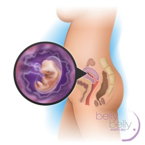 Worsened Morning Sickness