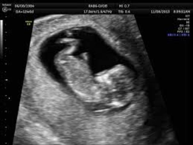 Week 13 of pregnancy