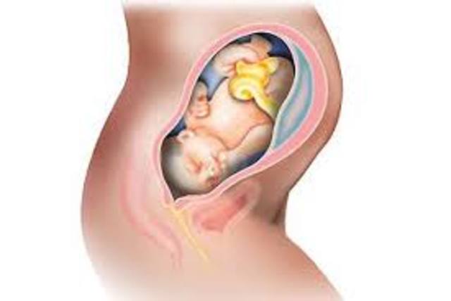 Week 38 of Pregnancy