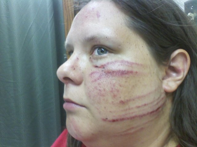 learned helmets are needed when riding a fourwheeler