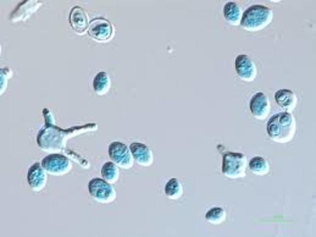 segundo Curso de micotoxinas y hongos toxigénicos