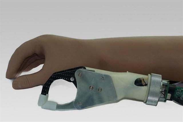 En Argentina crearon la primera prótesis bioeléctrica de América latina.