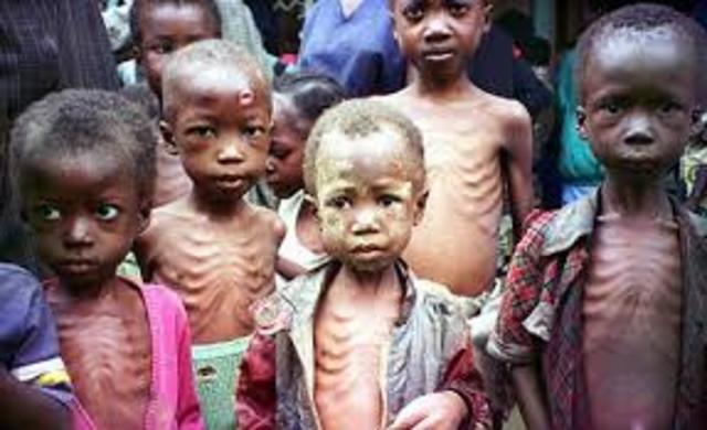 South African Malnutrition