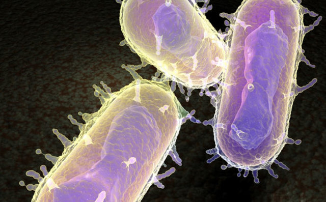 Moved Back Home due to Plague