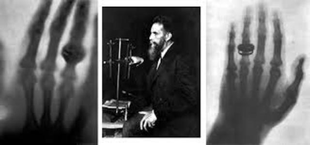 X-Rays were discovered by Wilhelm Roentgen.