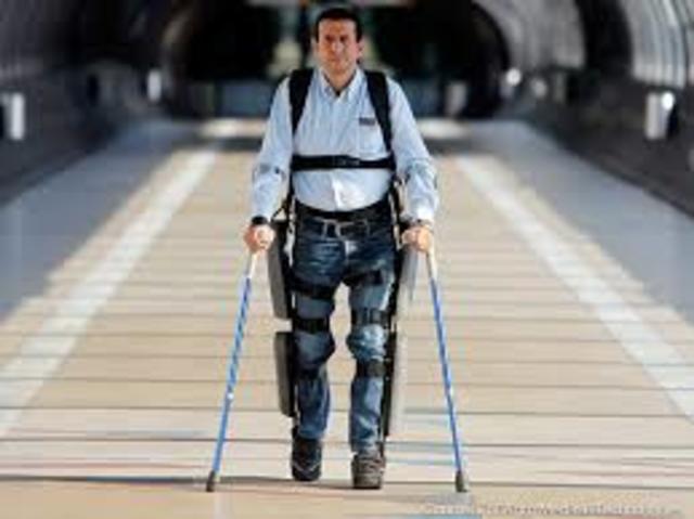 The first leg transplant surgery occurs.