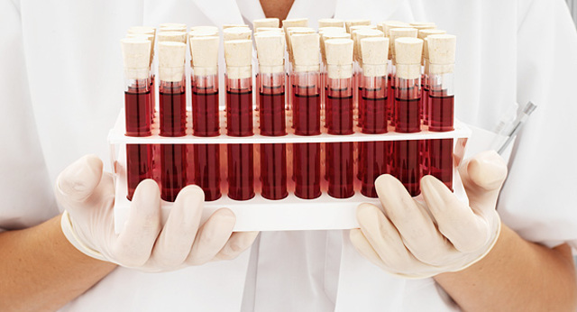 Analisis para descartar el virus