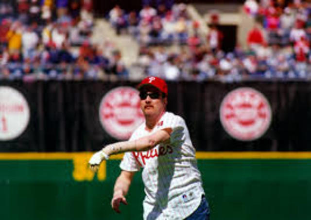 First Hand Transplant