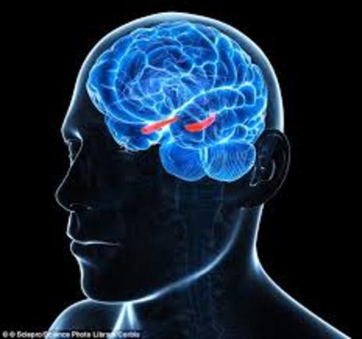 Brain Implants To Restore Lost Memory
