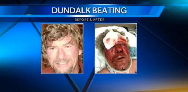 Dundaulk man assaulted during fight