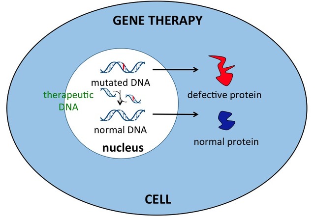 Gene Therapy