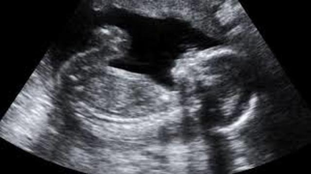 I got my first ultrasound, I was 4 months pregnant.