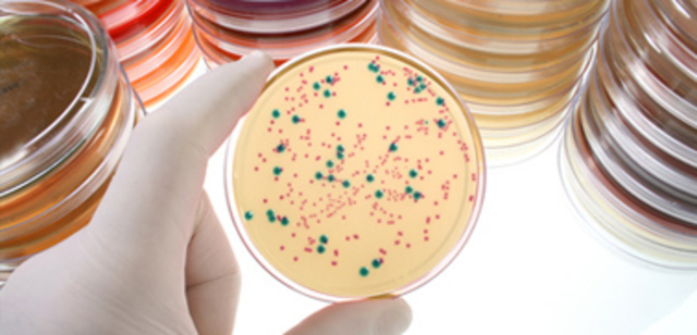 La microbiología de los alimentos