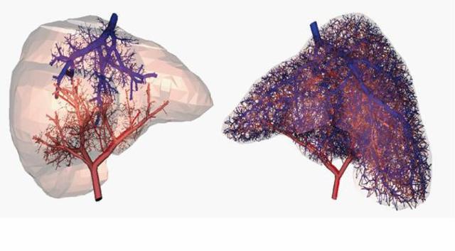 3D printed blood vessels