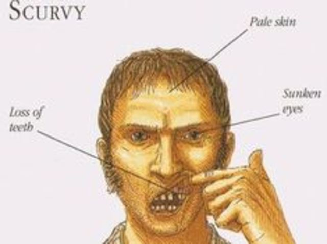 Scurvy