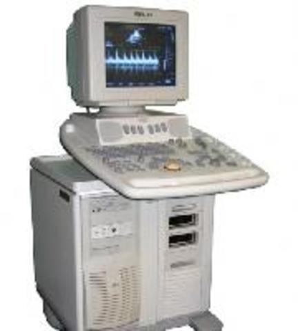 début de l'échographie suivit par le doppler