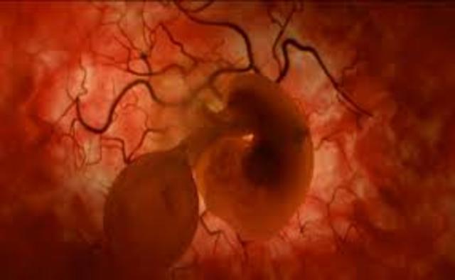 Semana tres de gestación