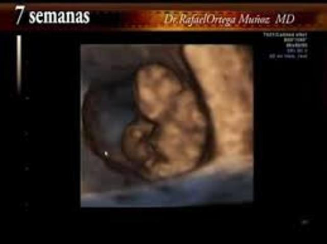 Semana septima de gestación
