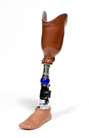 The below knee prosthetics