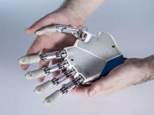 The bionic hand