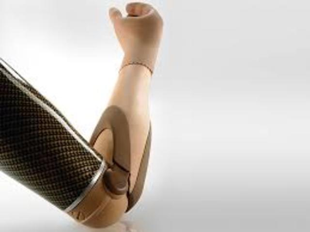 full arm prostheses