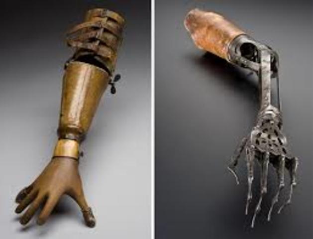 the pianist’s prosthetic