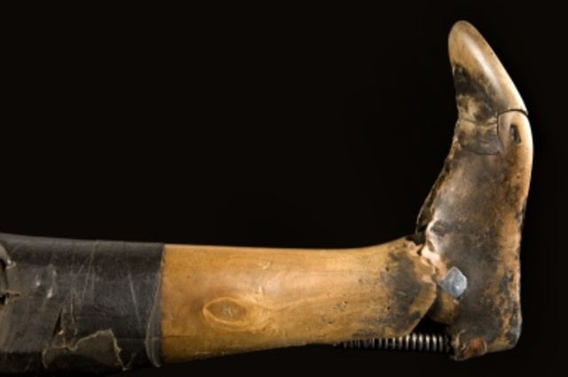articulated knee-and-foot prosthesis