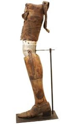 the first prosthetic leg