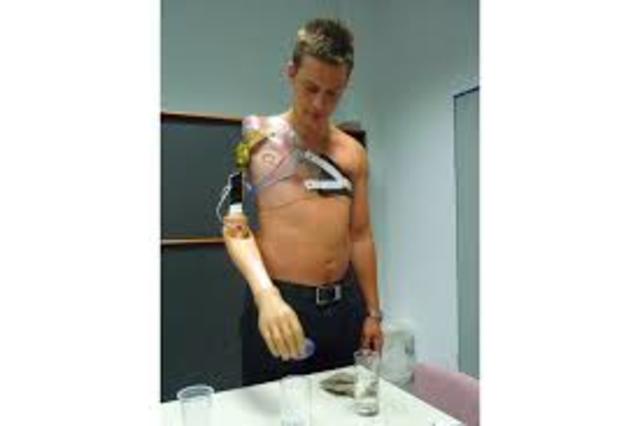 The mind controlled arm