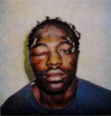 Rodney King Incident