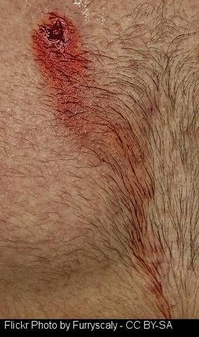 Un recepcionista é tiroteado