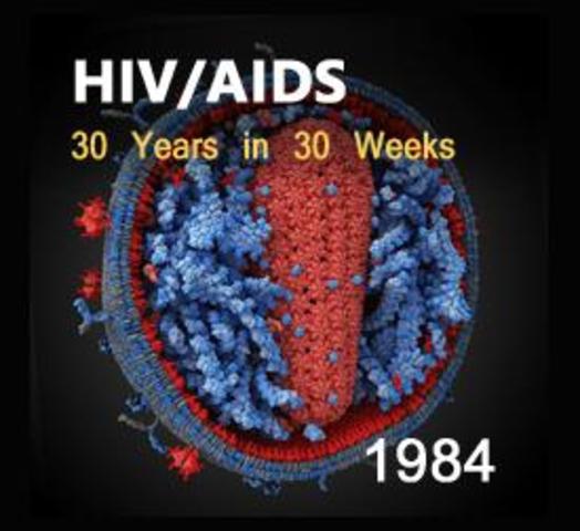 AIDS Virus is discovered
