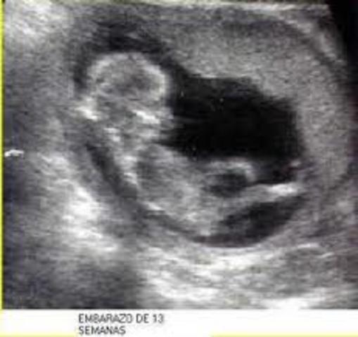 Semana decimo tercera de gestación
