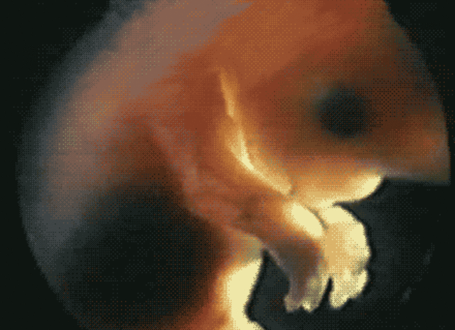 8 неделя развития эмбриона