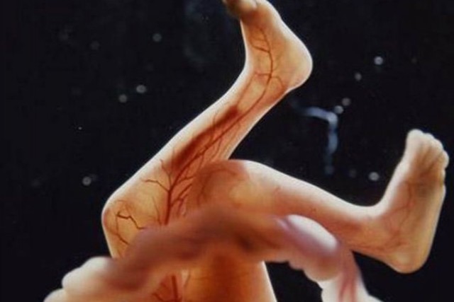 18 неделя развития эмбриона