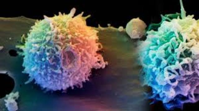 Se descubre el virus del VIH