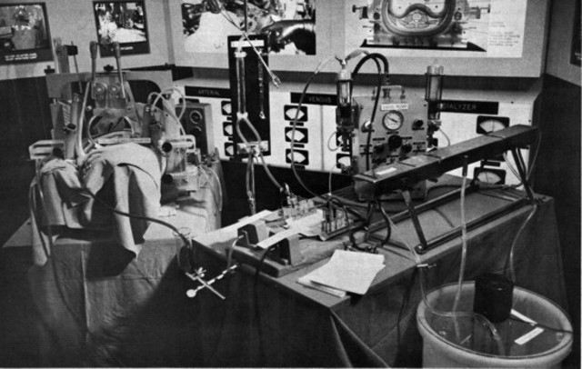 Desarrollo de la dialisis para insuficiencia renal