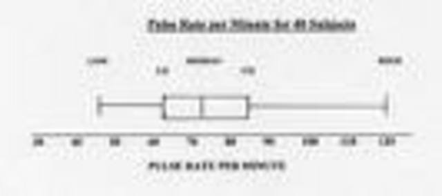 Box and Whisker Plot - Tukey