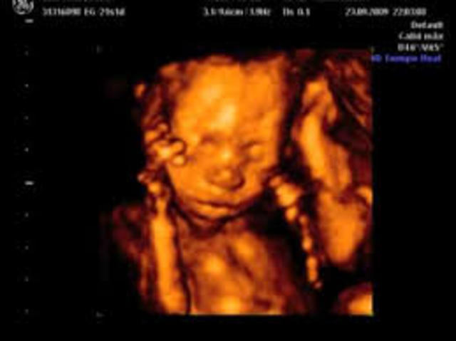 Semana vigecima primera de gestación