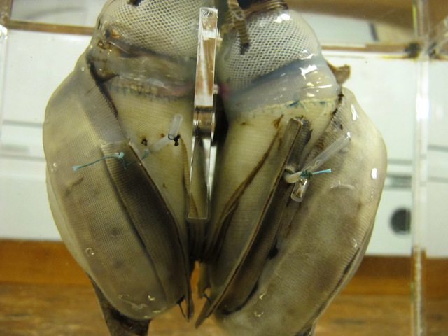 First Artificial Heart