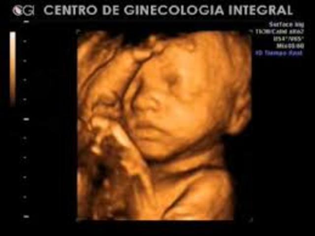 semana vigecimo octava de gestación