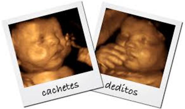 Semana vigecima  novena de gestación