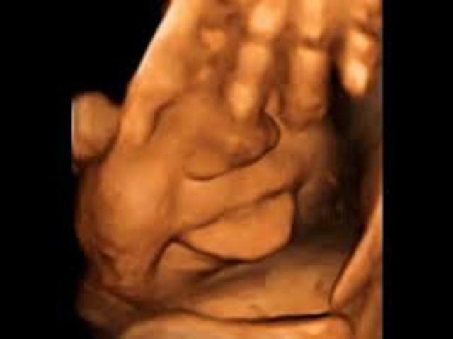 semanta trigecima de gestación