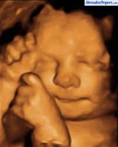 Semana trigecimo segunda de gestación