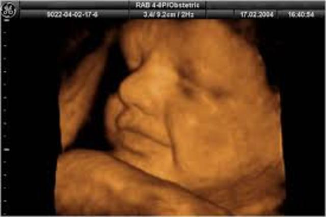 Semana trigecimo tercera de gestación