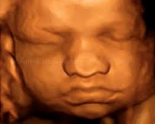 Semana trigecimo cuerta de gestación